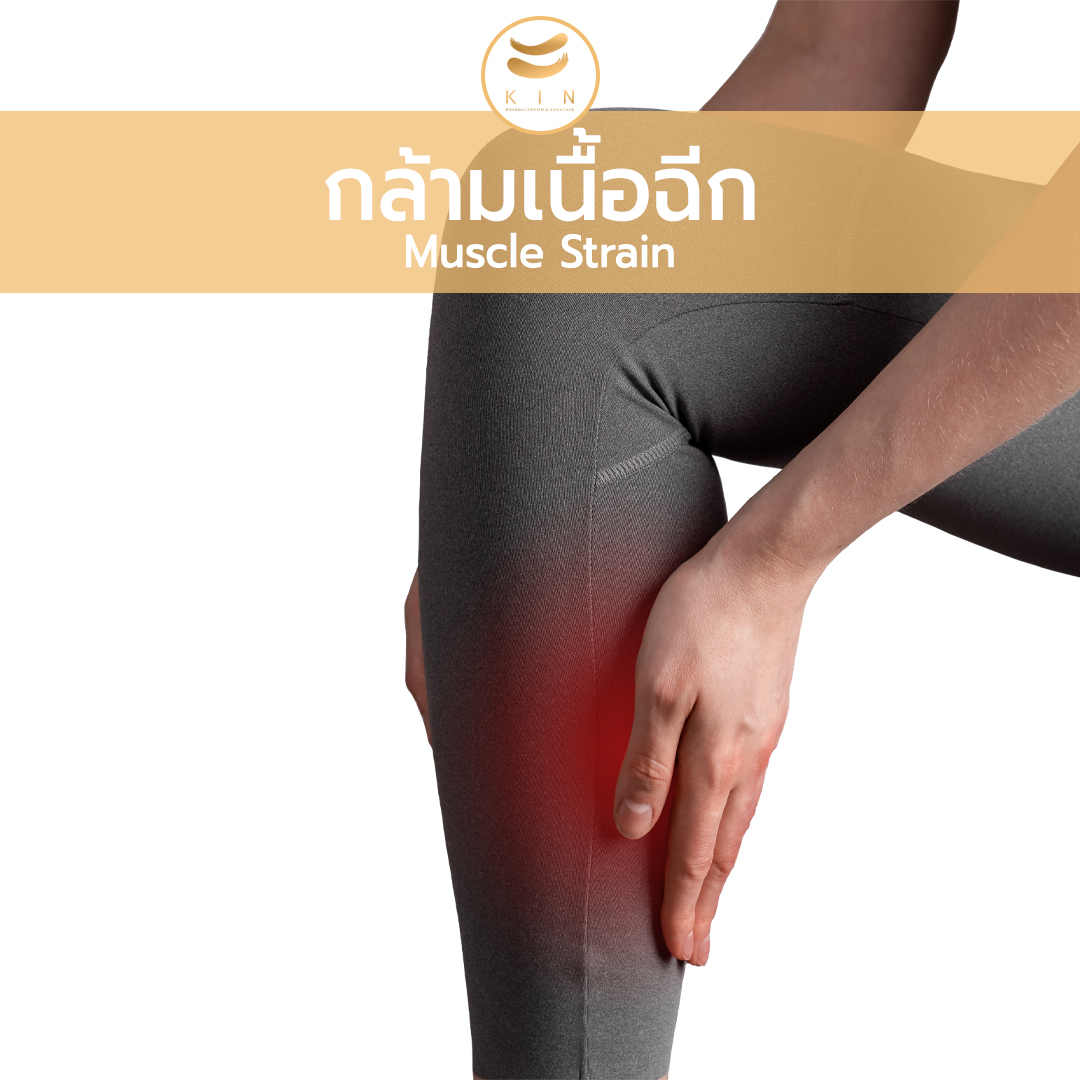 กล้ามเนื้อฉีก